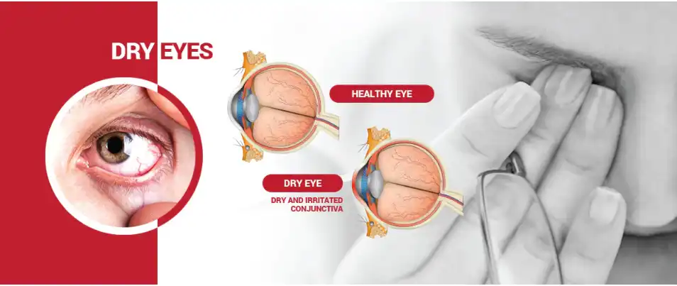 Astaxanthin powder protect vision